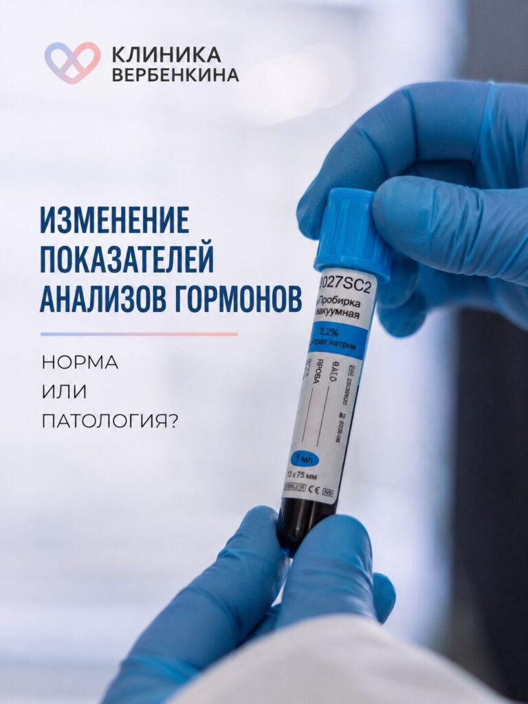 Изменение показателей анализов гормонов: норма или патология? Почему цифры скачут