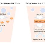 Лактазная недостаточность и генетика: почему молочка вызывает дискомфорт