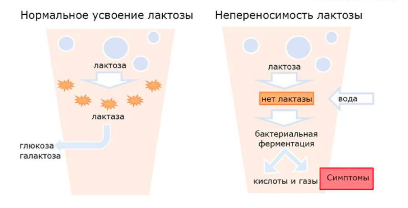 Лактазная недостаточность и генетика: почему молочка вызывает дискомфорт