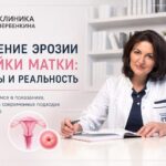 Эрозия шейки матки: симптомы, мифы и нужно ли лечить