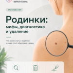 Родинки: мифы, диагностика и удаление