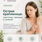 Острая крапивница: симптомы, причины и лечение